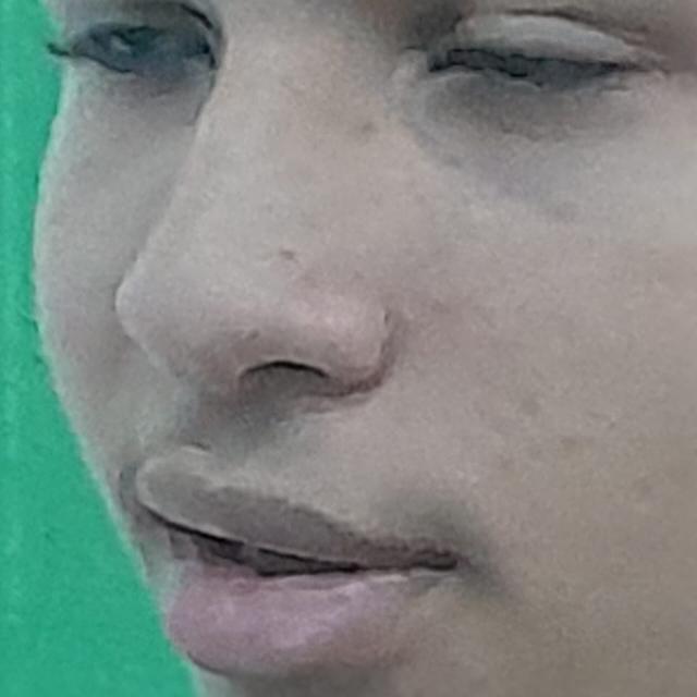 Ruindade anal Ruindade anal